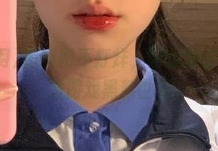 First Image